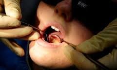 رشد قارچ گونه لابراتوارهای دندانپزشکی غیر مجاز در بانه