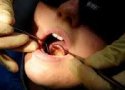 رشد قارچ گونه لابراتوارهای دندانپزشکی غیر مجاز در بانه